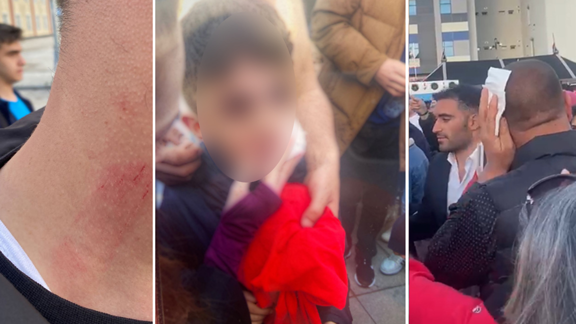 Erzurum'daki provokasyon hakkında validen açıklama: 7 kişi yaralandı
