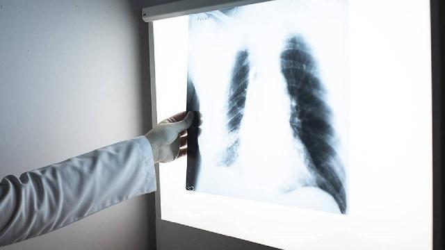 İnsan akciğerinde ilk kez mikroplastiğe rastlandı