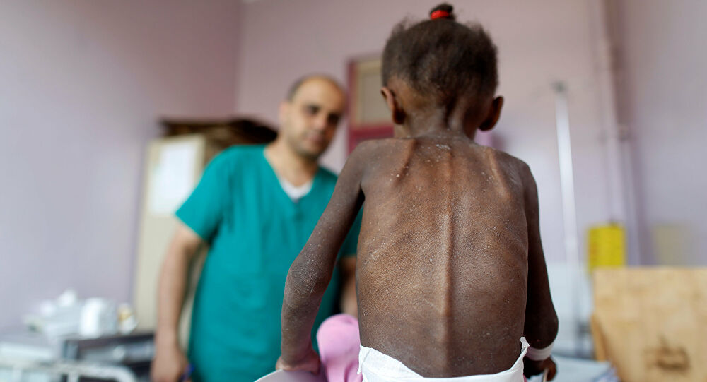 UNICEF: Salgın Yemen'de milyonlarca çocuğu açlığın eşiğine itebilir